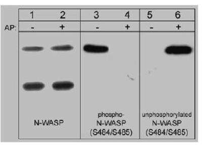 Western Blot: N-WASP [p Ser484, p Ser485] Antibody [NBP2-29669]